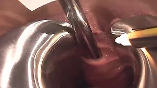 NLRMF