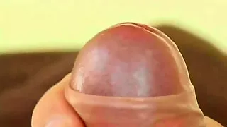 Foreskin Part 1