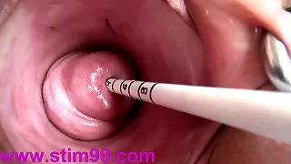 Extreme Real Cervix Fucking Insertion Objects in Utherus