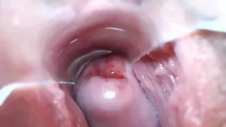 Cervix show 7